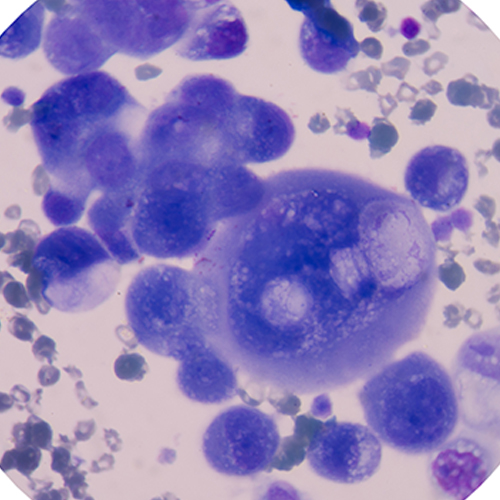 cancer cells