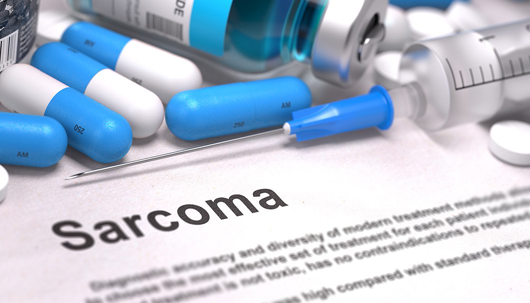 Breakthrough in Ewing Sarcoma Research image