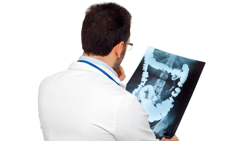 Colorectal Cancer Awareness Month and the Importance of Screening for Early Diagnosis Doctor Examines Colorectal x-ray