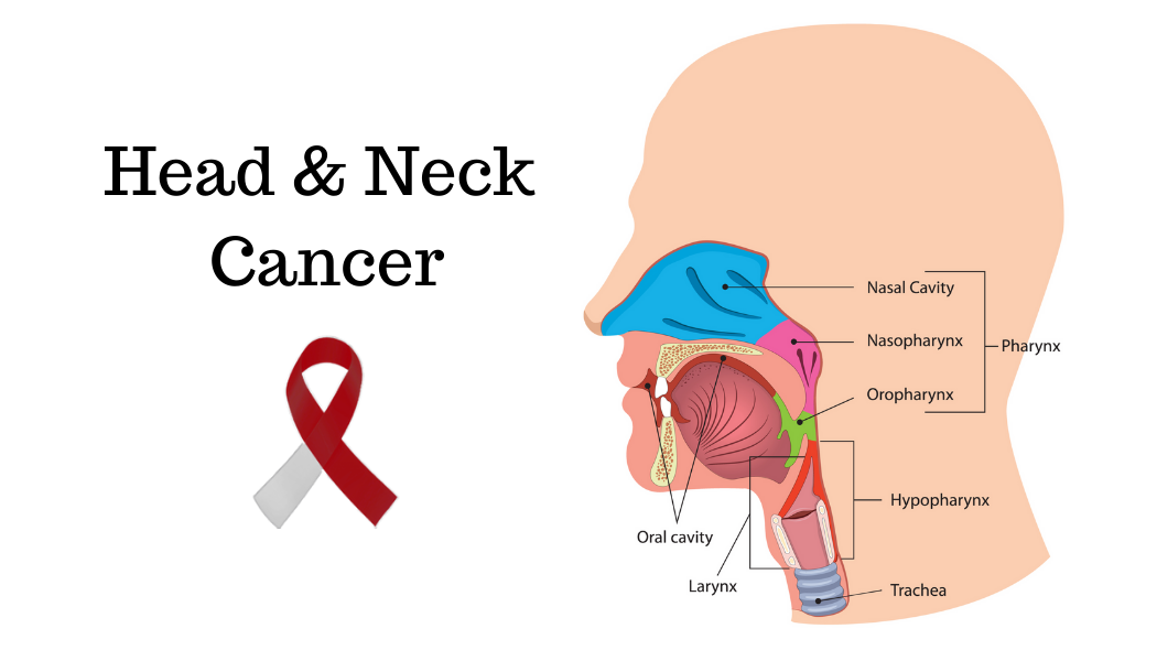 head and neck cancers Head and Neck Cancers