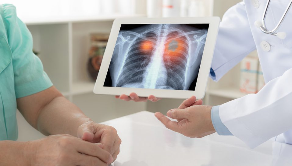 Cancer Staging