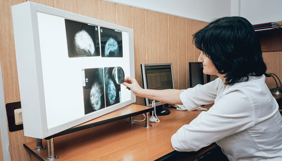 Mastectomy 101