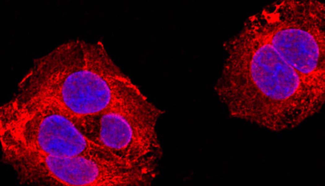 Better Understanding of Enzyme Mutation Process Provides Hope for New Pathways to Treatment 1050x600