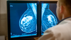 Cancer Screening Mammogram Cancer Screening