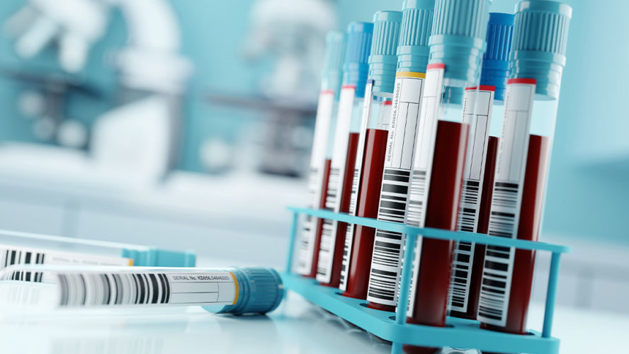 ISOPSA Prostate Cancer Screening