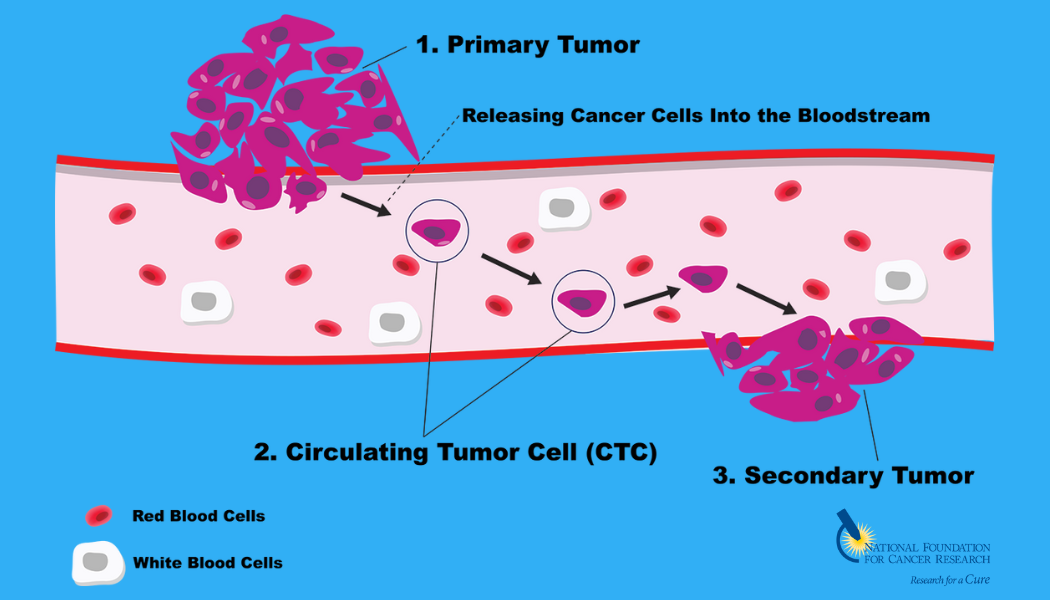 CTC Graphic for Web with NFCR logo