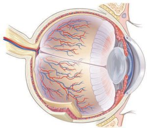 CAR Graphic cancer-associated retinopathy (CAR)