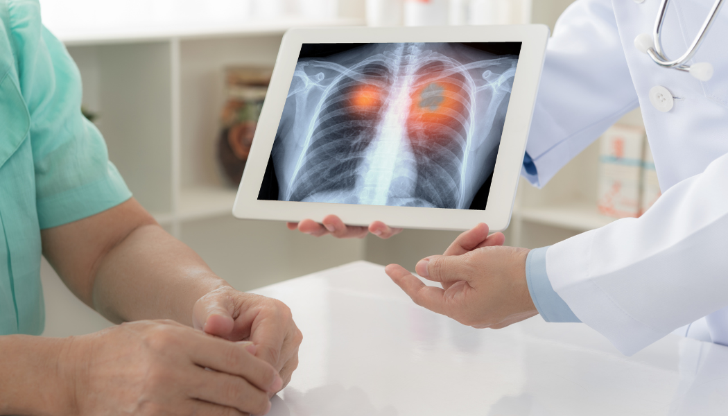 Cancer Diagnosis & Molecular imaging