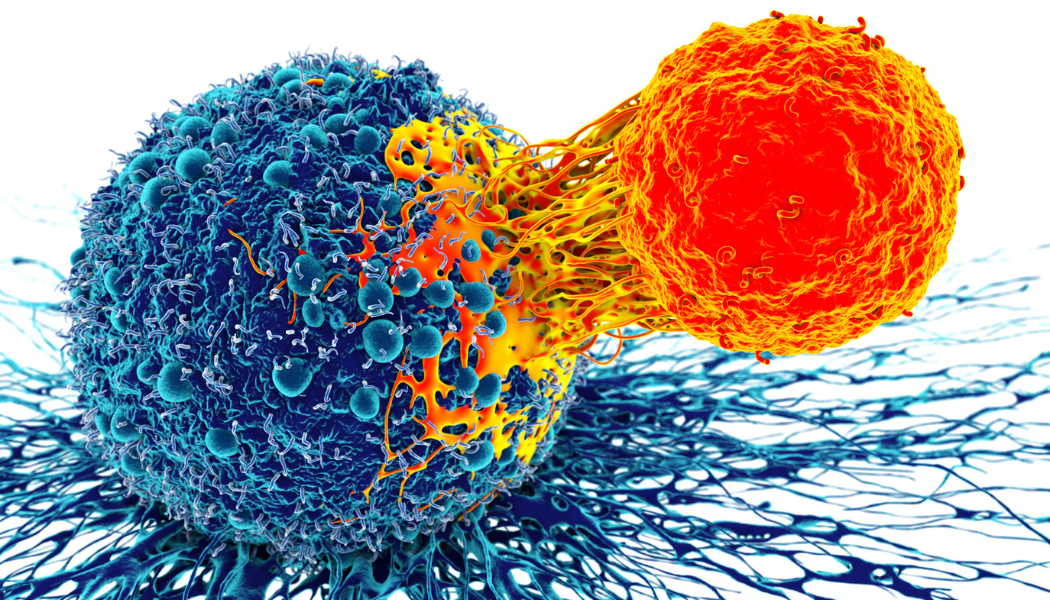 Cancer Metastasis