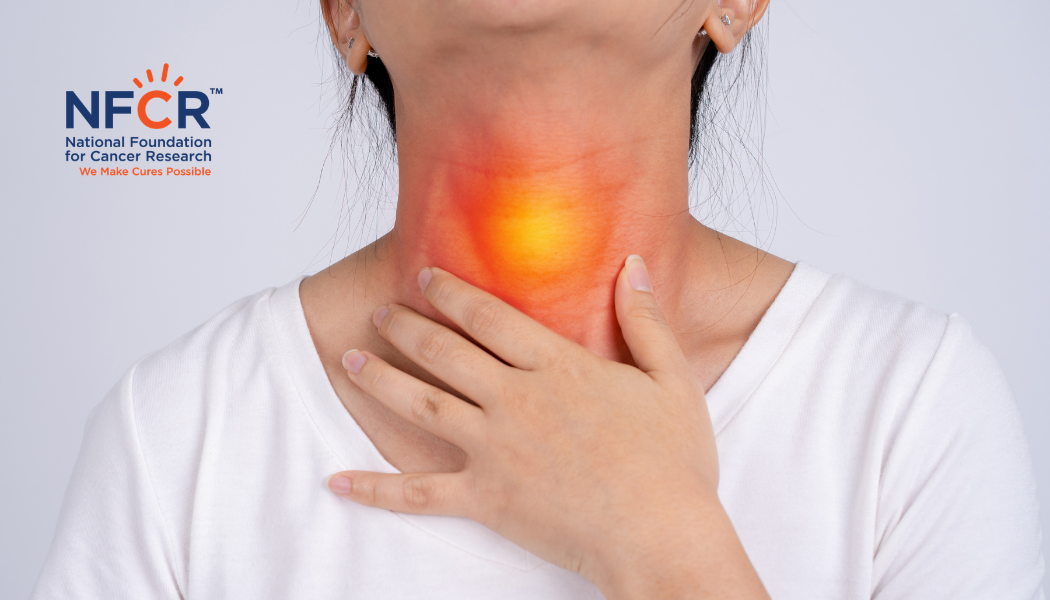 Head & Neck Cancer Feature