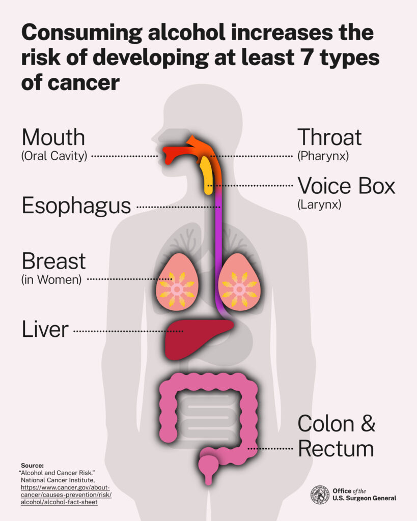 oash-alcohol-cancer-fig3